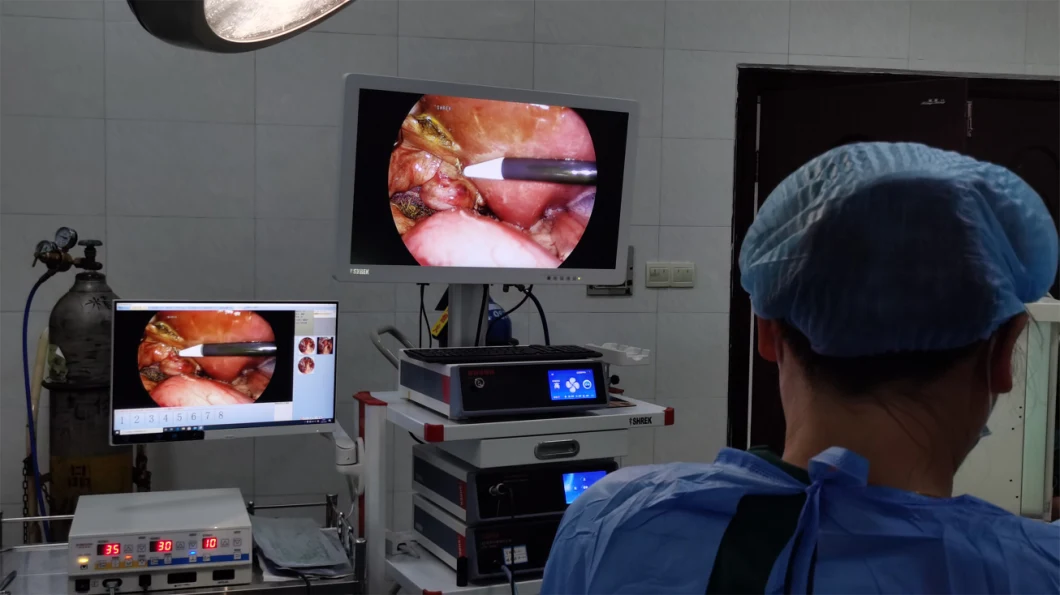 Laparoscopic Smoke Evacuation System for Medical Procedure